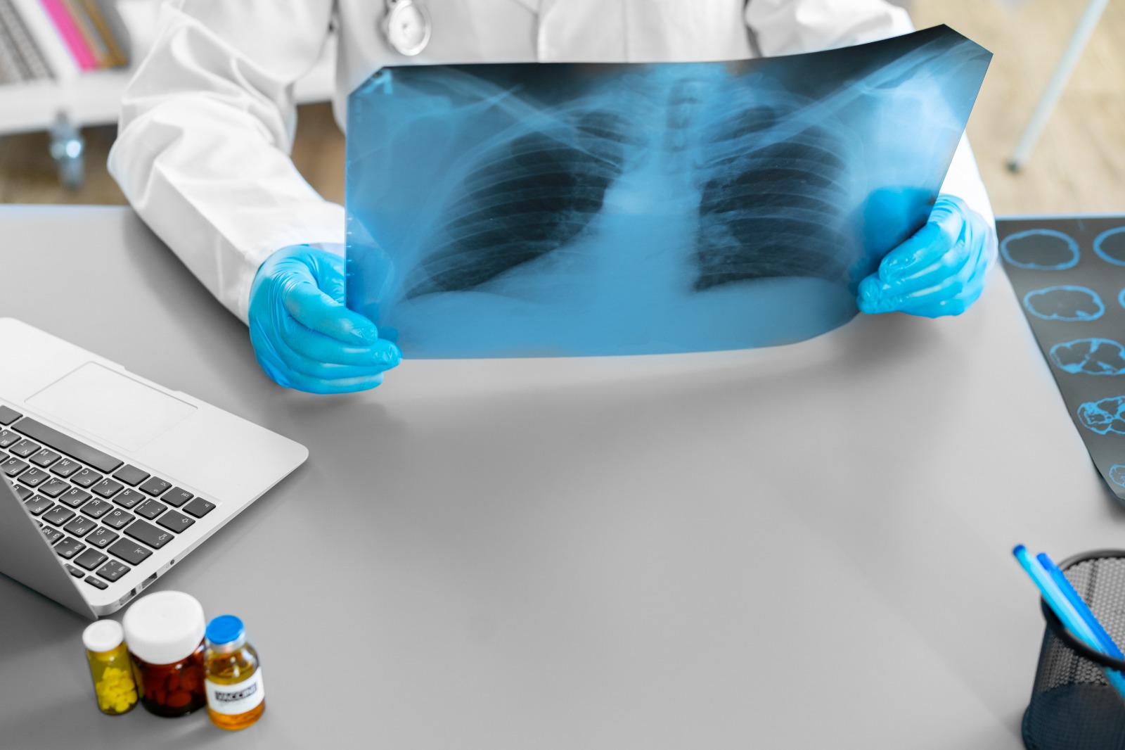 radiografía de pulmones
